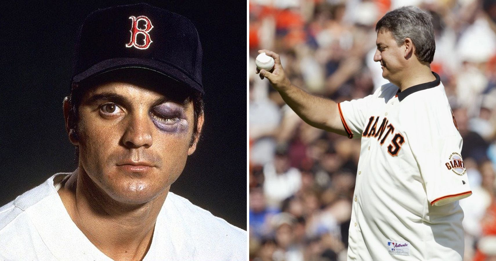 7 MLB Players Who Overcame Horrific Injuries And 8 Who Didn't